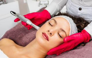 micro-needling
